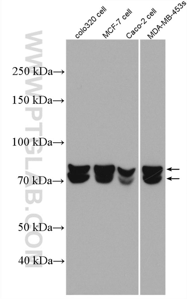 HNRNPM Antibody in Western Blot (WB)