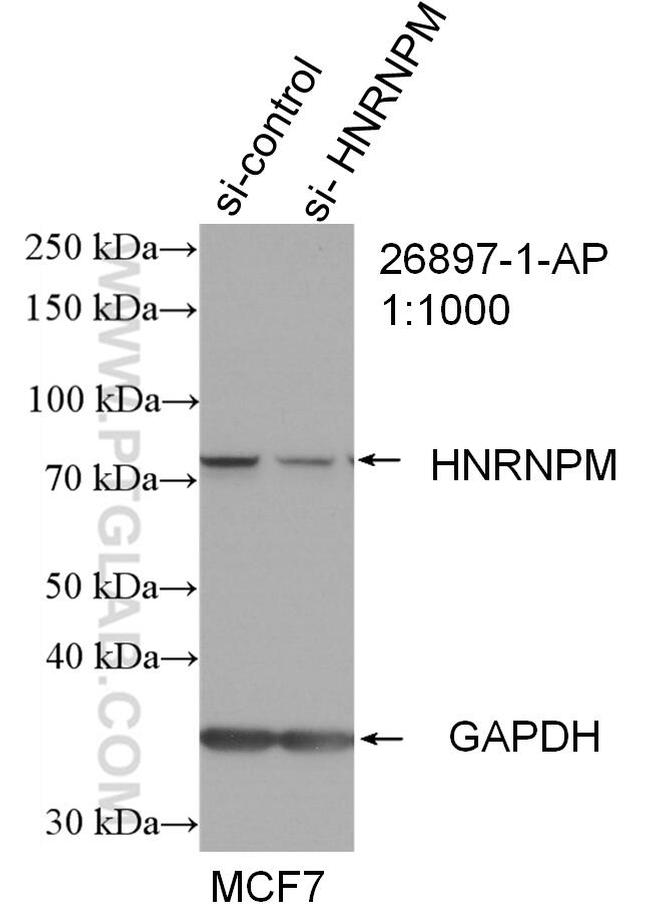 HNRNPM Antibody in Western Blot (WB)