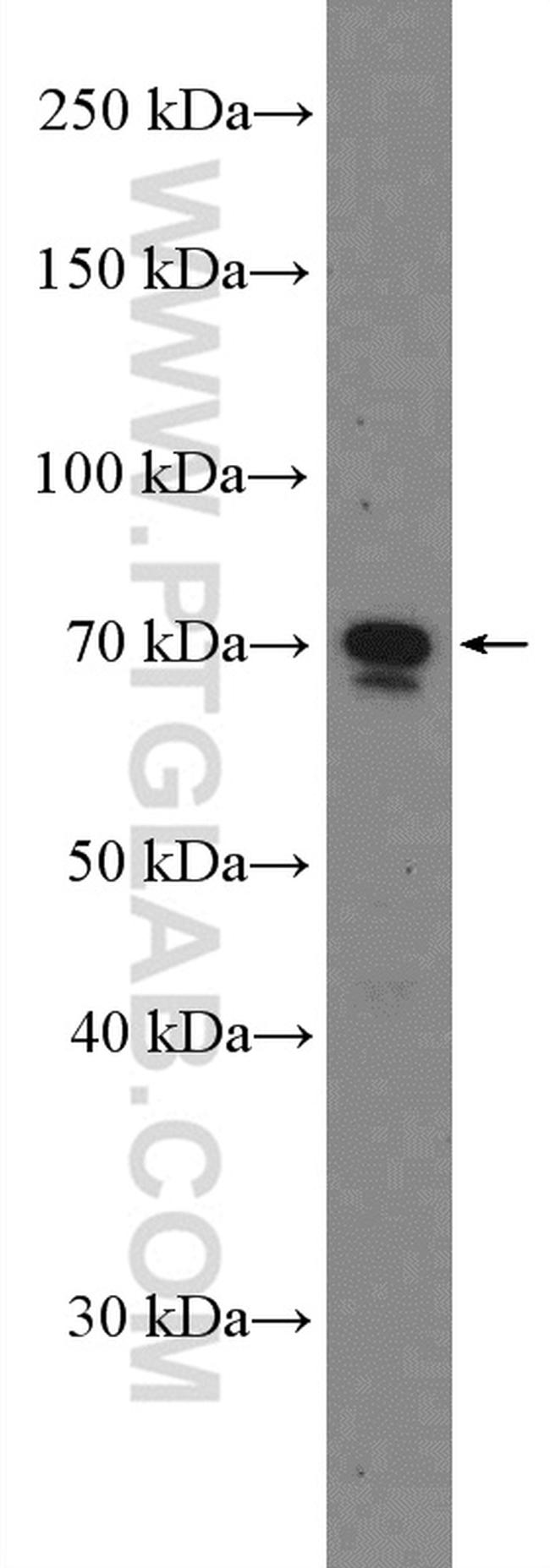 HNRNPM Antibody in Western Blot (WB)