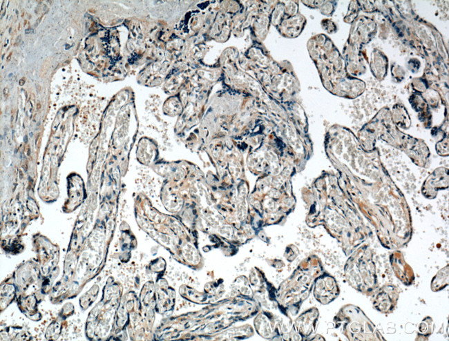 PKC zeta Antibody in Immunohistochemistry (Paraffin) (IHC (P))