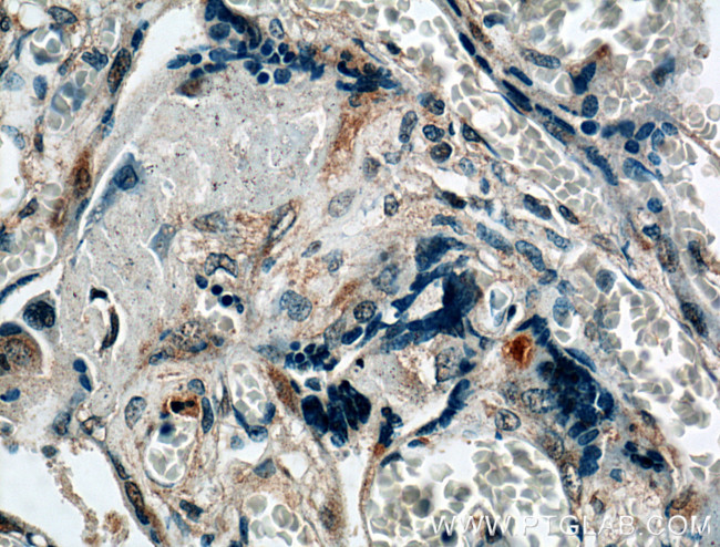 PKC zeta Antibody in Immunohistochemistry (Paraffin) (IHC (P))