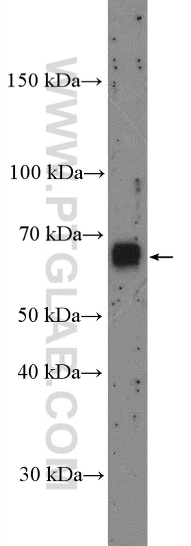 PKC zeta Antibody in Western Blot (WB)