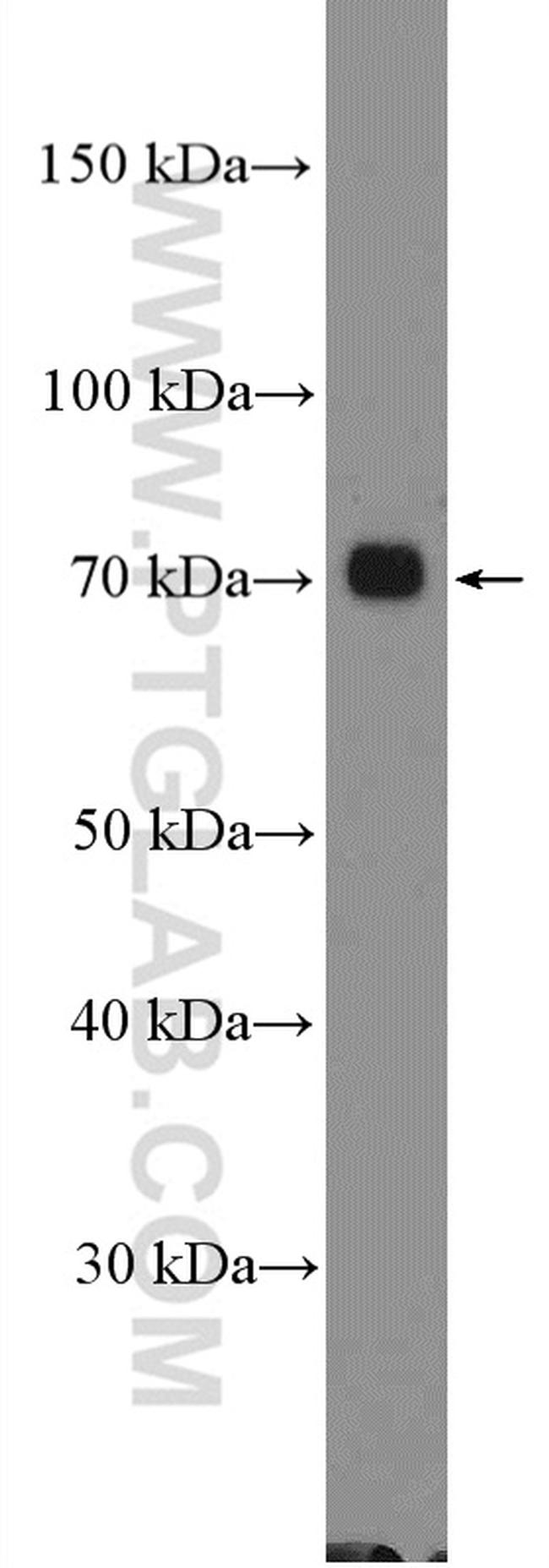 PKC zeta Antibody in Western Blot (WB)