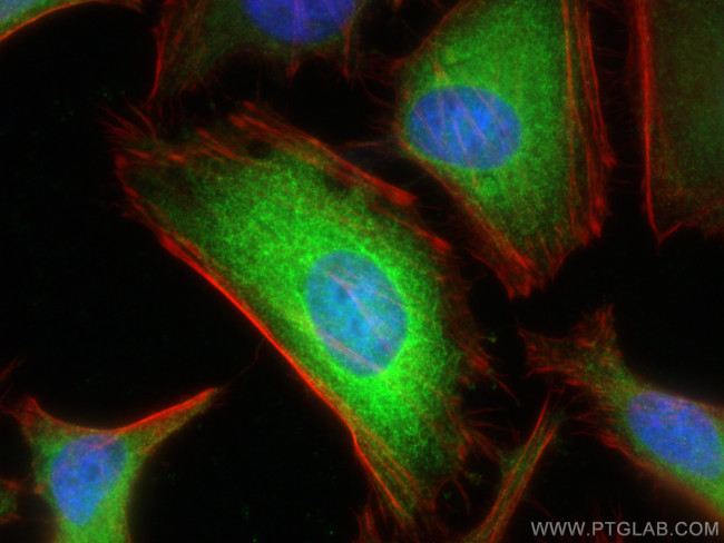 NDRG1 Antibody in Immunocytochemistry (ICC/IF)