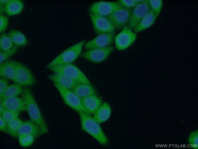 NDRG1 Antibody in Immunocytochemistry (ICC/IF)