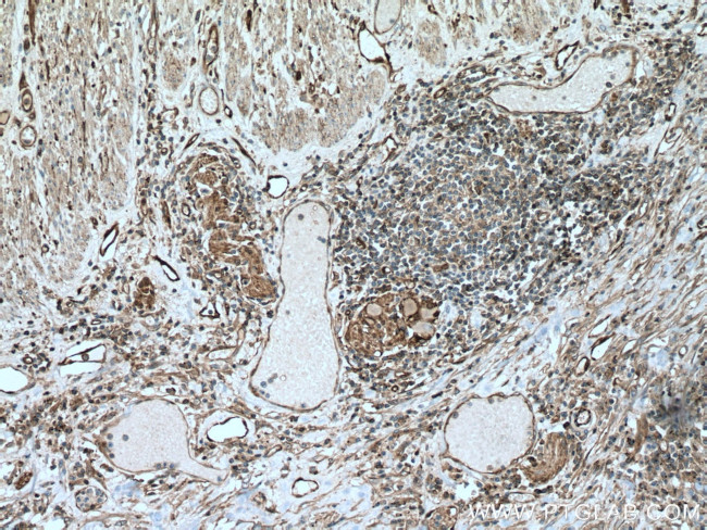 NDRG1 Antibody in Immunohistochemistry (Paraffin) (IHC (P))