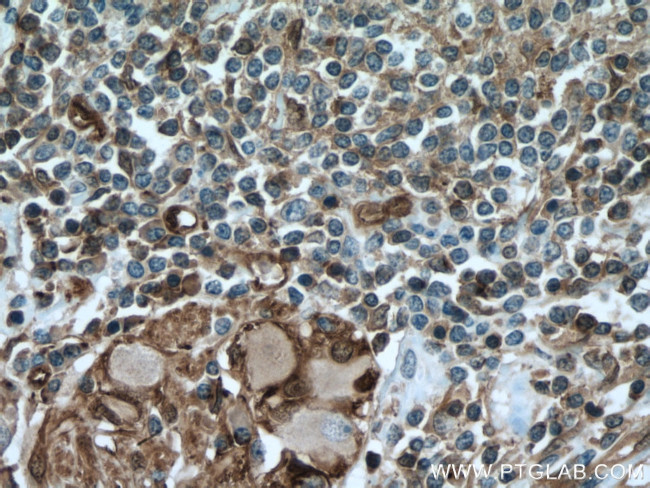 NDRG1 Antibody in Immunohistochemistry (Paraffin) (IHC (P))