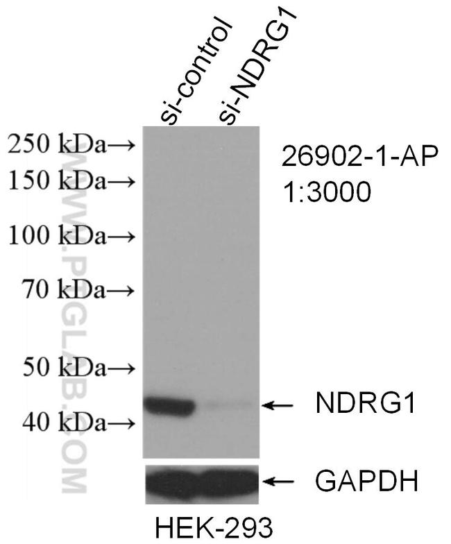 NDRG1 Antibody in Western Blot (WB)