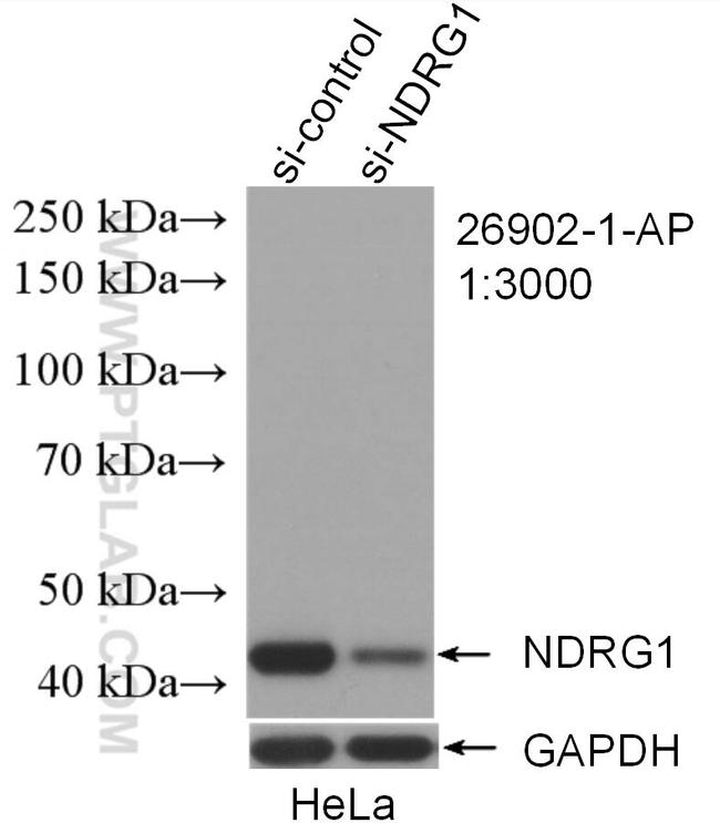 NDRG1 Antibody in Western Blot (WB)