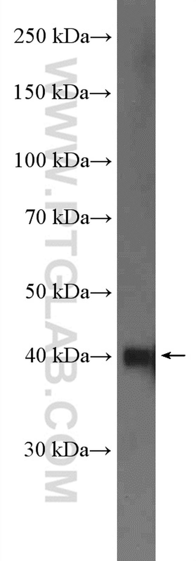 NDRG1 Antibody in Western Blot (WB)