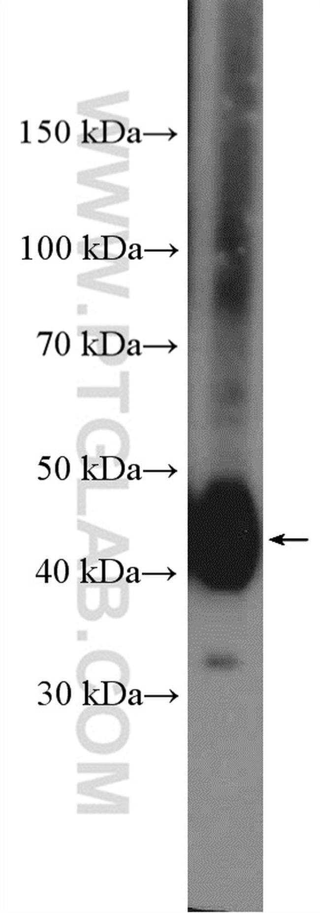 NDRG1 Antibody in Western Blot (WB)