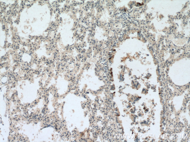 Uteroglobin Antibody in Immunohistochemistry (Paraffin) (IHC (P))