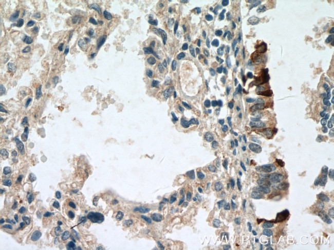 Uteroglobin Antibody in Immunohistochemistry (Paraffin) (IHC (P))