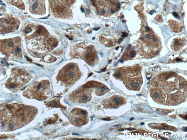 DUSP7/PYST2 Antibody in Immunohistochemistry (Paraffin) (IHC (P))