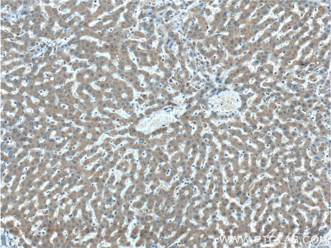 DUSP7/PYST2 Antibody in Immunohistochemistry (Paraffin) (IHC (P))