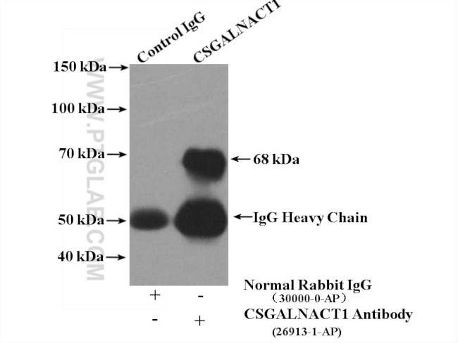CSGALNACT1 Antibody in Immunoprecipitation (IP)