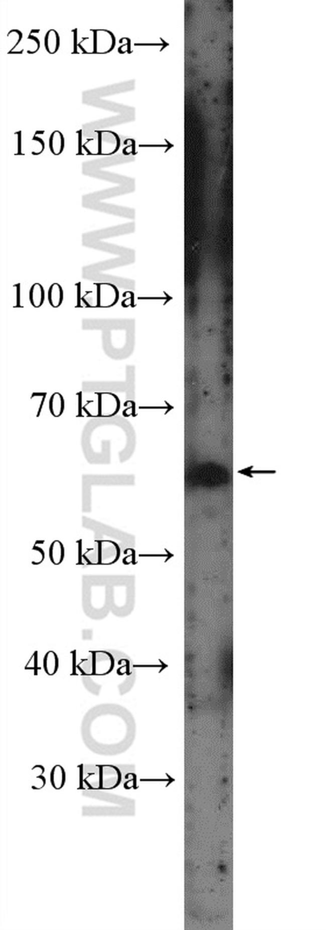 CSGALNACT1 Antibody in Western Blot (WB)