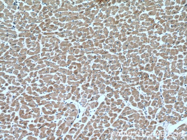 VEGFD Antibody in Immunohistochemistry (Paraffin) (IHC (P))