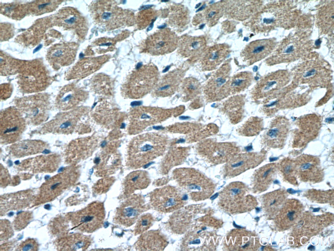 VEGFD Antibody in Immunohistochemistry (Paraffin) (IHC (P))