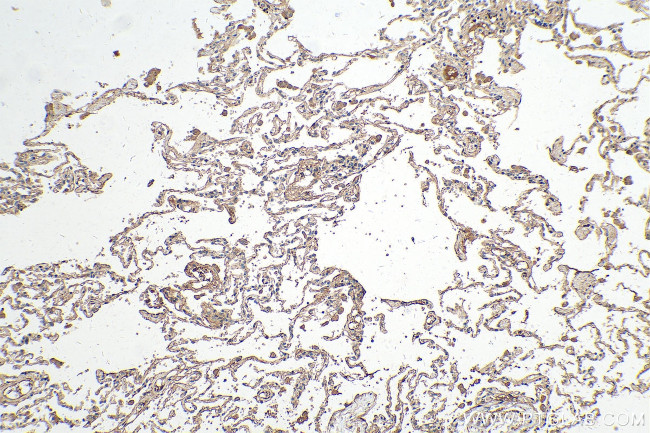 VEGFD Antibody in Immunohistochemistry (Paraffin) (IHC (P))