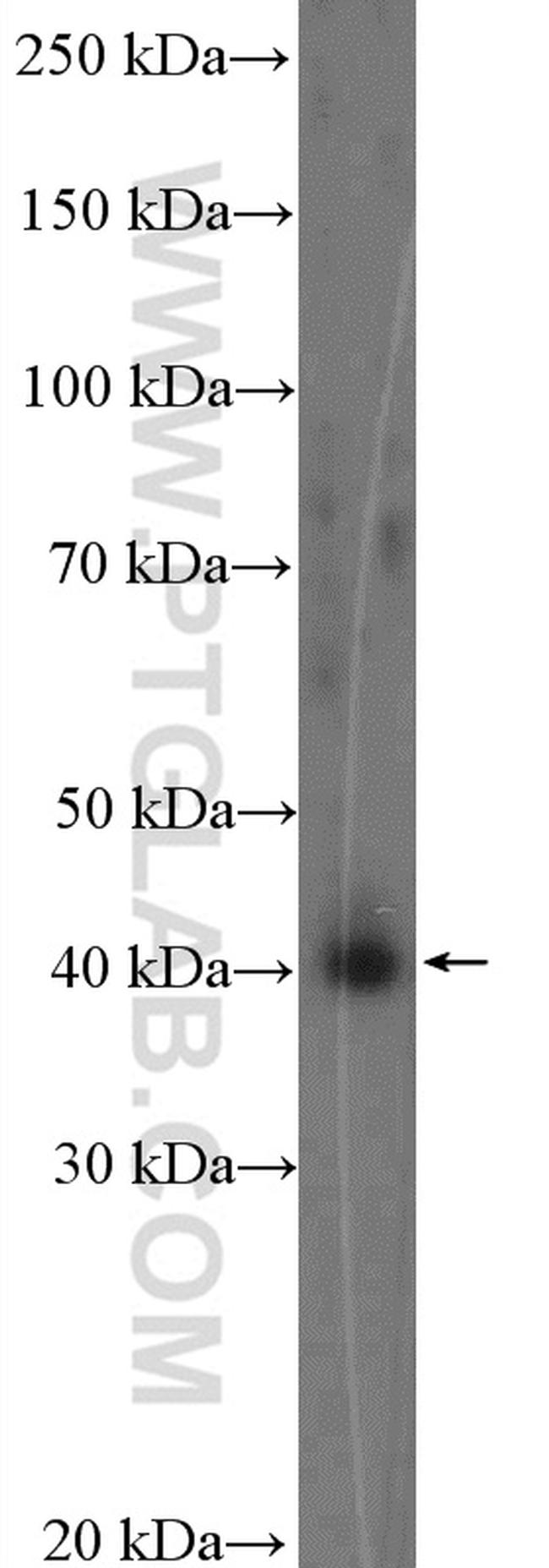 VEGFD Antibody in Western Blot (WB)