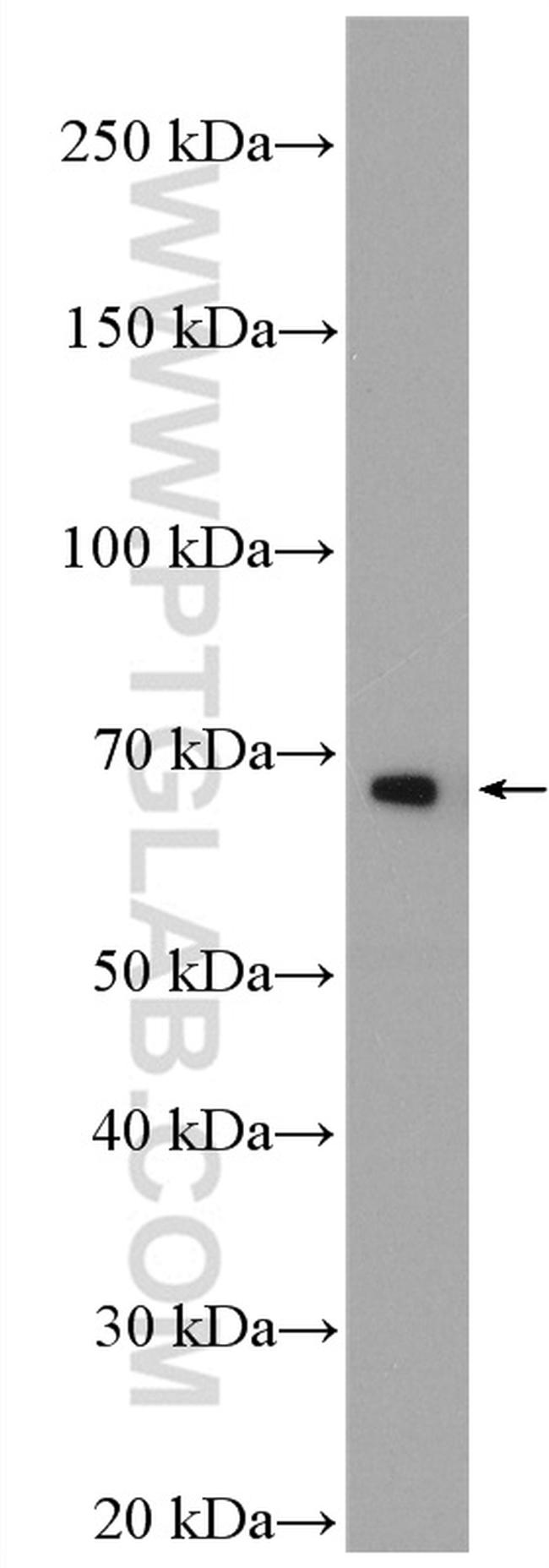 TRAF5 Antibody in Western Blot (WB)