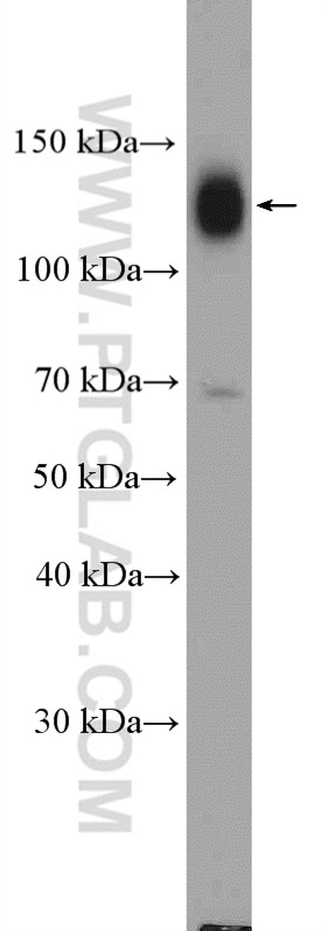 Integrin beta-1 Antibody in Western Blot (WB)