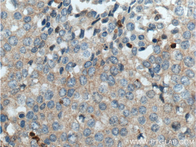 Integrin beta-1 Antibody in Immunohistochemistry (Paraffin) (IHC (P))