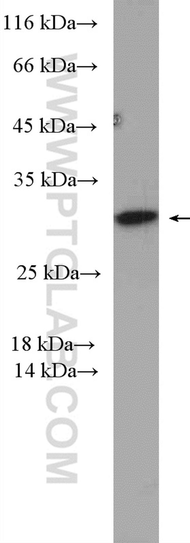 PSMD9 Antibody in Western Blot (WB)