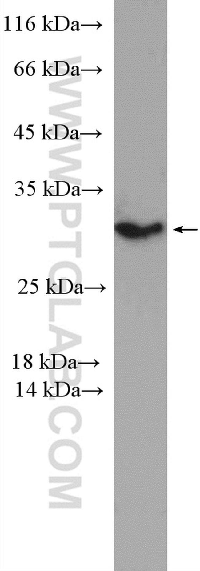 PSMD9 Antibody in Western Blot (WB)