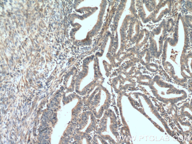 ADAM12 Antibody in Immunohistochemistry (Paraffin) (IHC (P))