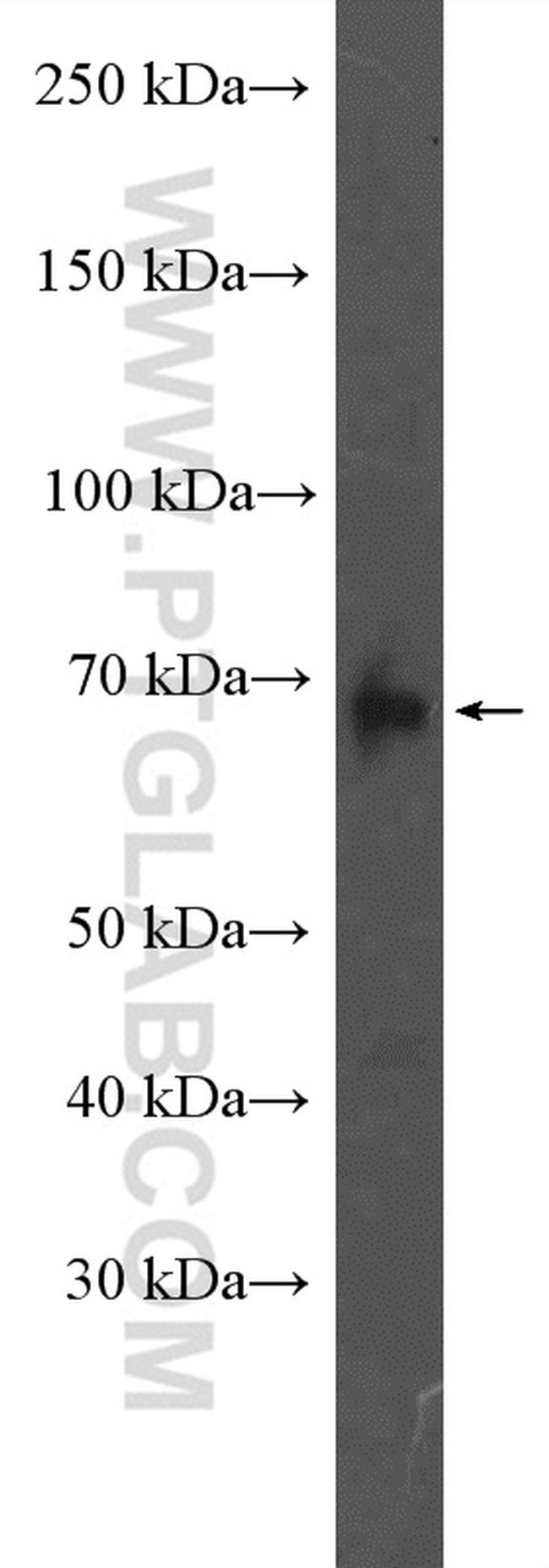 ADAM12 Antibody in Western Blot (WB)