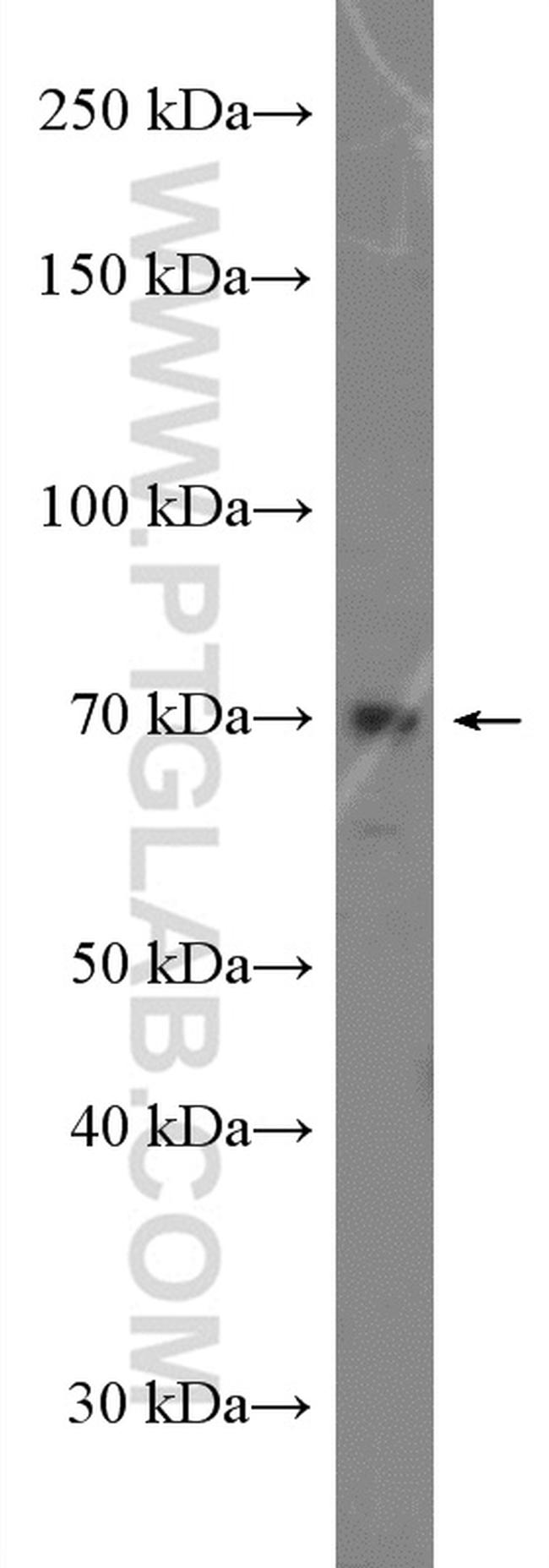 ADAM12 Antibody in Western Blot (WB)