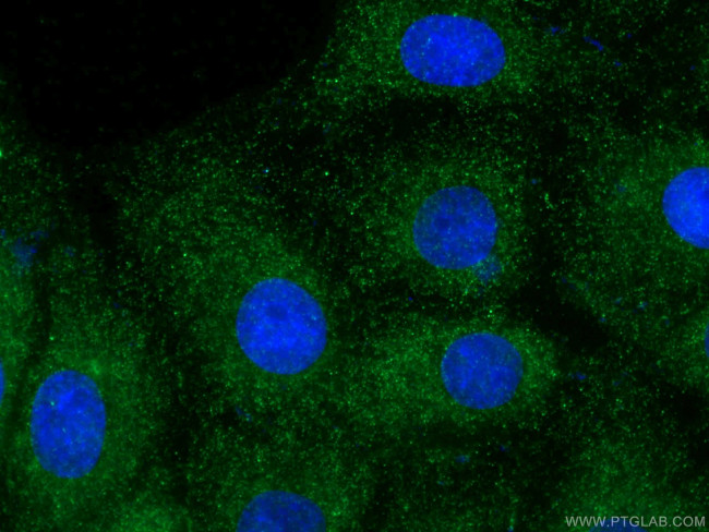 Fibrillin 1 Antibody in Immunocytochemistry (ICC/IF)