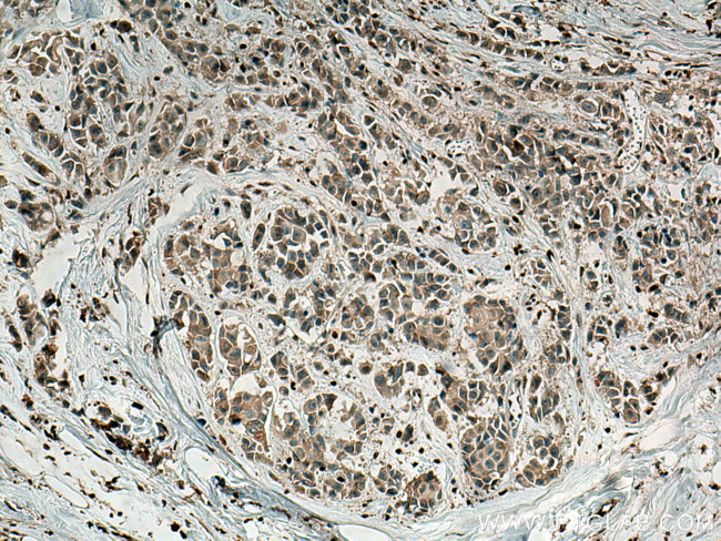 Fibrillin 1 Antibody in Immunohistochemistry (Paraffin) (IHC (P))