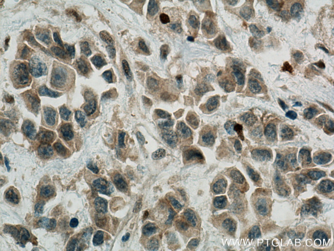 Fibrillin 1 Antibody in Immunohistochemistry (Paraffin) (IHC (P))