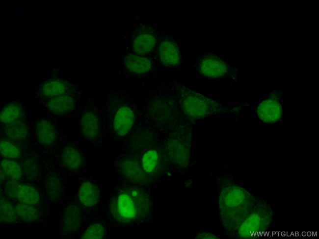 Cyclin D1 Antibody in Immunocytochemistry (ICC/IF)