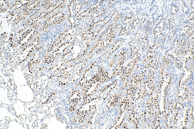 Cyclin D1 Antibody in Immunohistochemistry (Paraffin) (IHC (P))