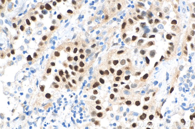 Cyclin D1 Antibody in Immunohistochemistry (Paraffin) (IHC (P))