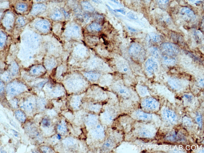 F11R Antibody in Immunohistochemistry (Paraffin) (IHC (P))