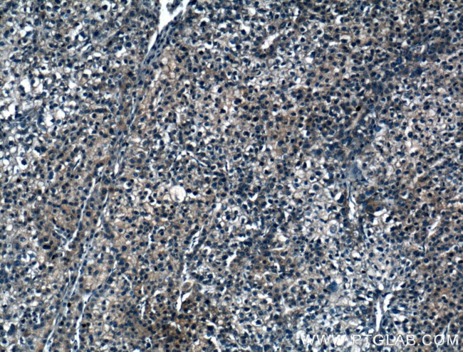 IARS Antibody in Immunohistochemistry (Paraffin) (IHC (P))