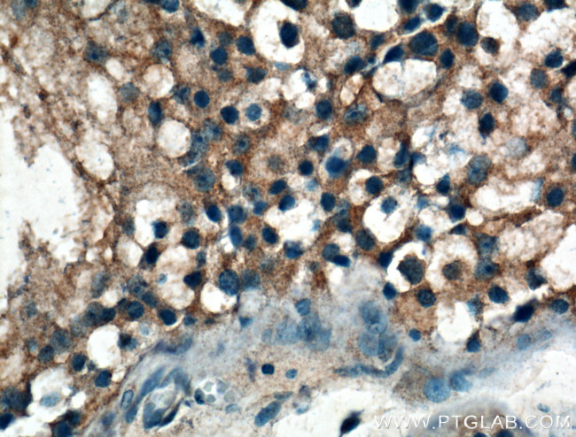 IARS Antibody in Immunohistochemistry (Paraffin) (IHC (P))