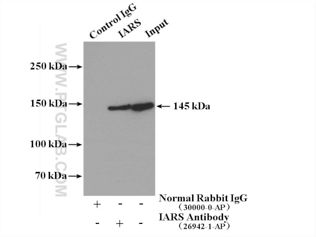 IARS Antibody in Immunoprecipitation (IP)