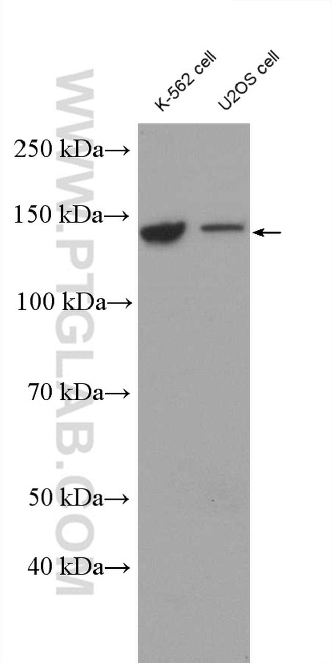 IARS Antibody in Western Blot (WB)