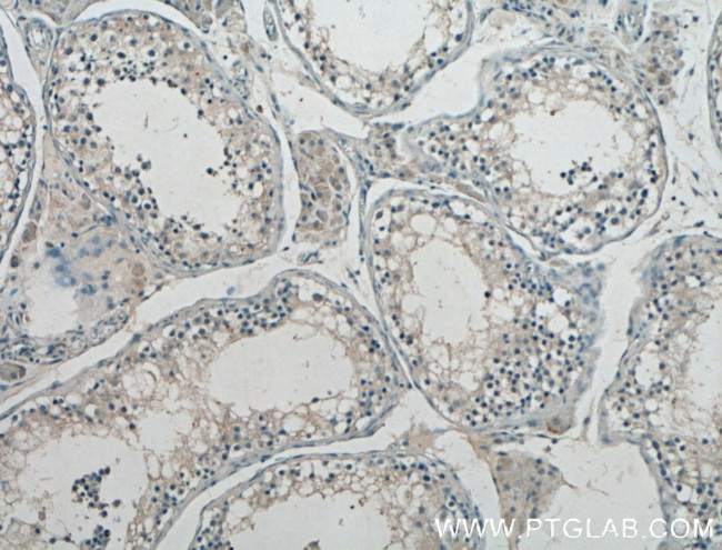 GnRH Antibody in Immunohistochemistry (Paraffin) (IHC (P))