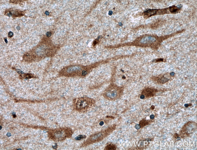 GnRH Antibody in Immunohistochemistry (Paraffin) (IHC (P))