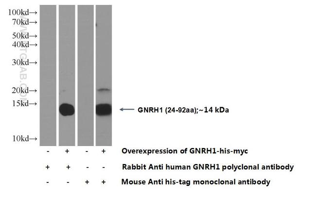 GnRH Antibody in Western Blot (WB)