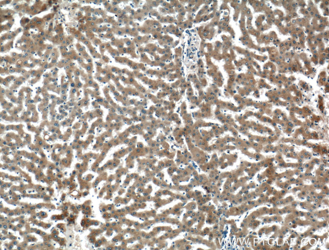 Perilipin 5 Antibody in Immunohistochemistry (Paraffin) (IHC (P))