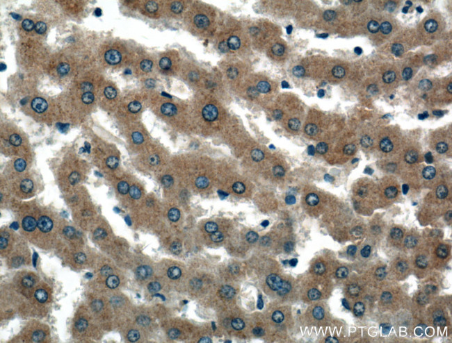 Perilipin 5 Antibody in Immunohistochemistry (Paraffin) (IHC (P))