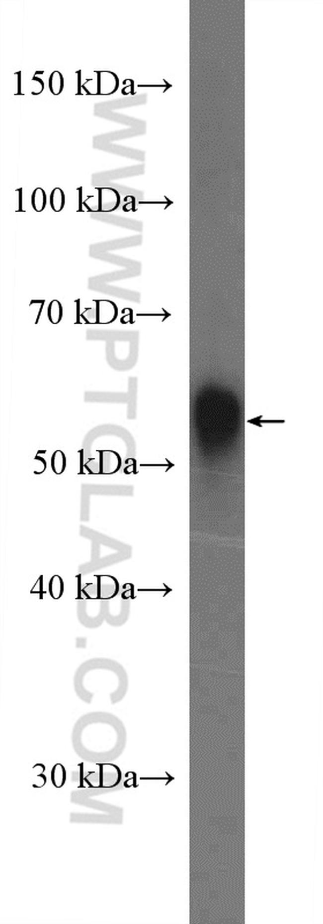 Perilipin 5 Antibody in Western Blot (WB)